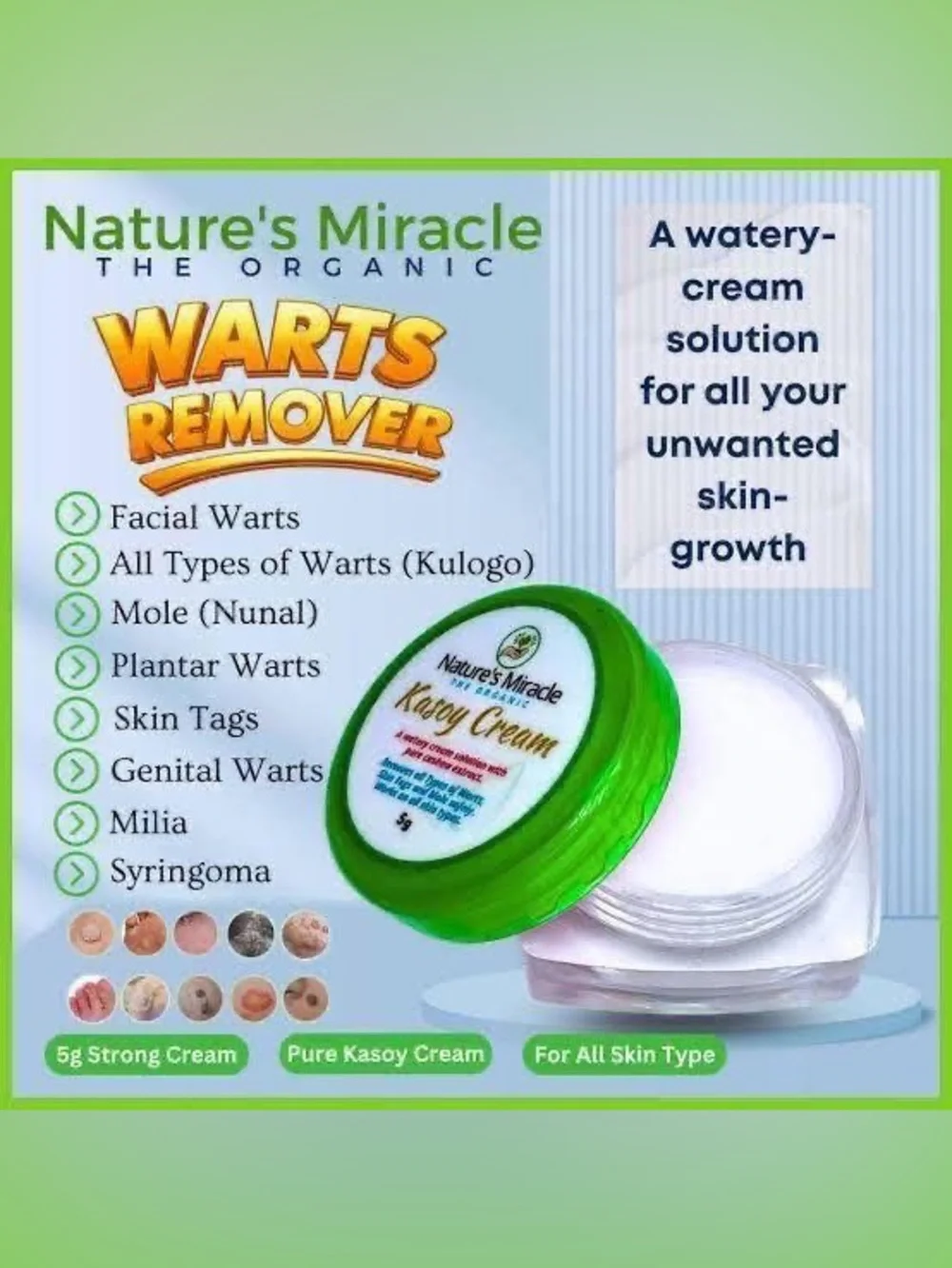 Kasoy Cream - Wart Remover and Skin Tags